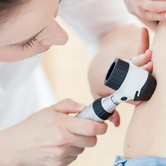 Hautärztin untersucht mit einem Dermatoskop ein Muttermal am unteren Rücken einer Patientin.
