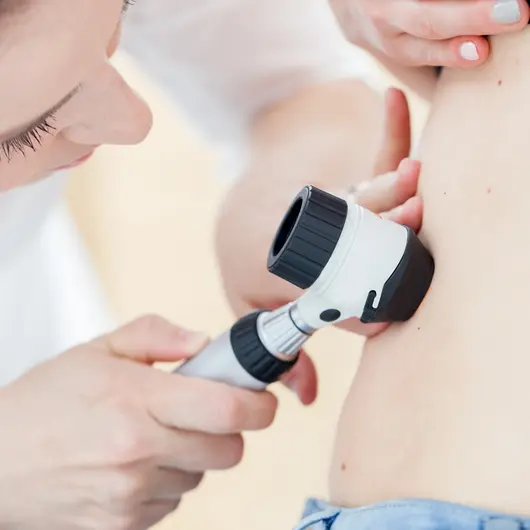 A dermatologist examines a mole on a patient's lower back with a dermatoscope.